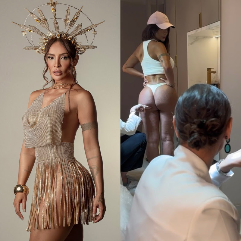 Carol Nakamura faz tratamento para o “bumbum triste” no Carnaval 2026